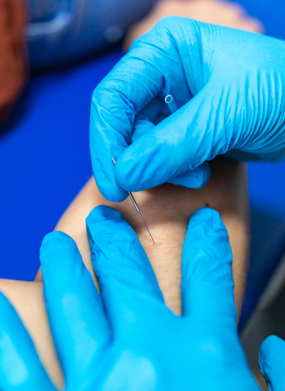 Terapia manualna + suche igłowanie